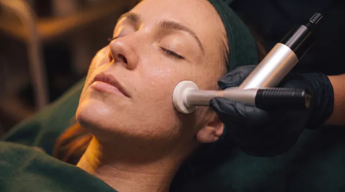 Microneedling skin-texture treatment at Altru Radiance in Murray, Utah